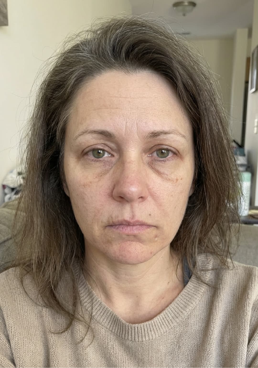 User skin before routine