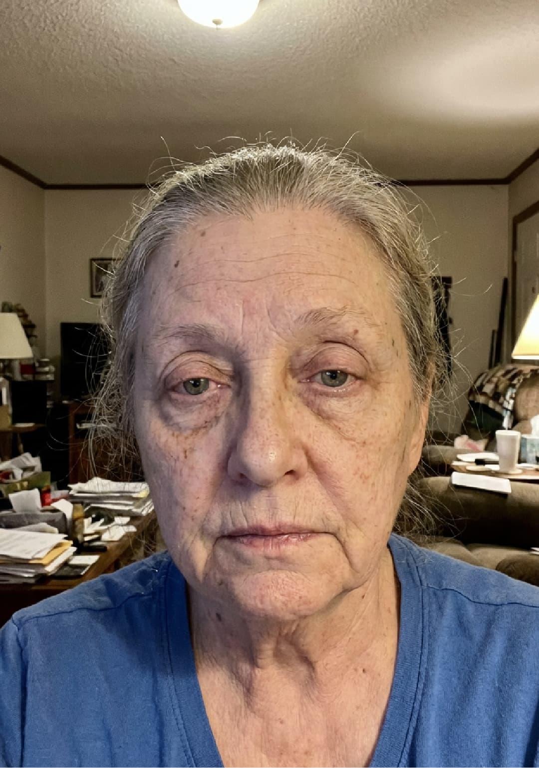 User skin before routine