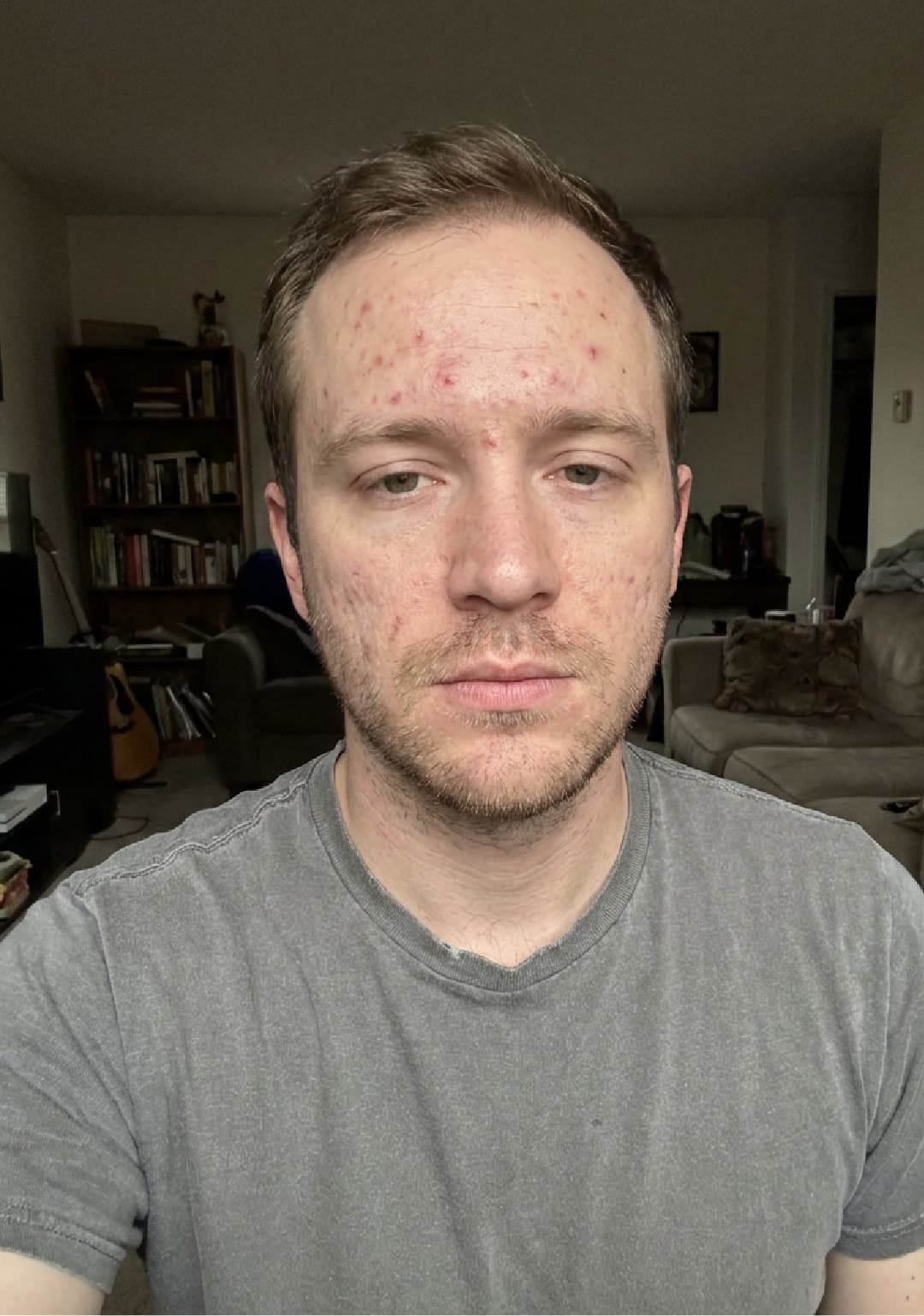 User skin before routine